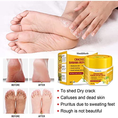 Hidratantna hranjiva krema za njegu stopala protiv pukotina, pogodna za grube suhe ispucale ruke i stopala